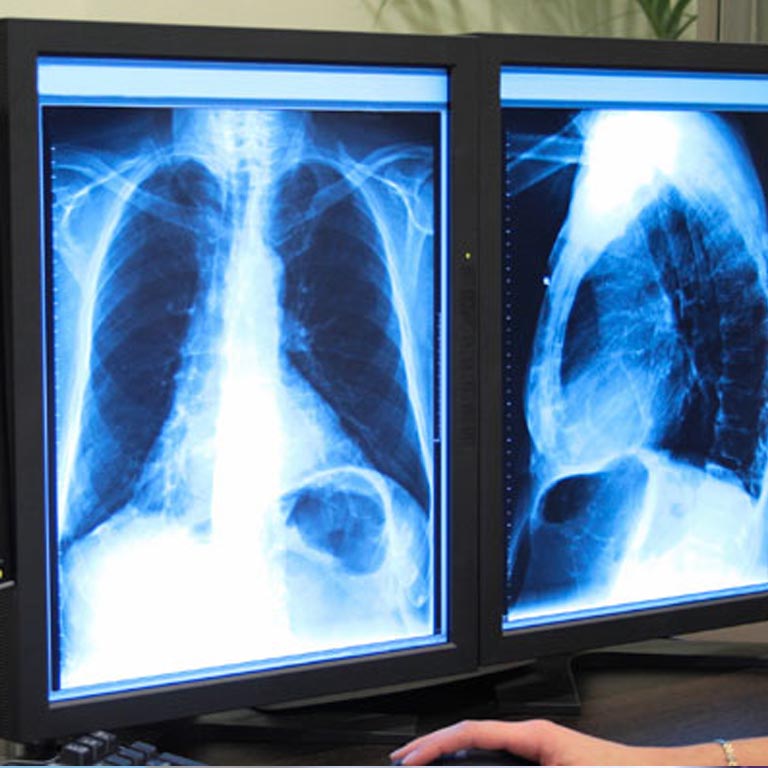 DIGITAL X-RAY Babbar Hospital