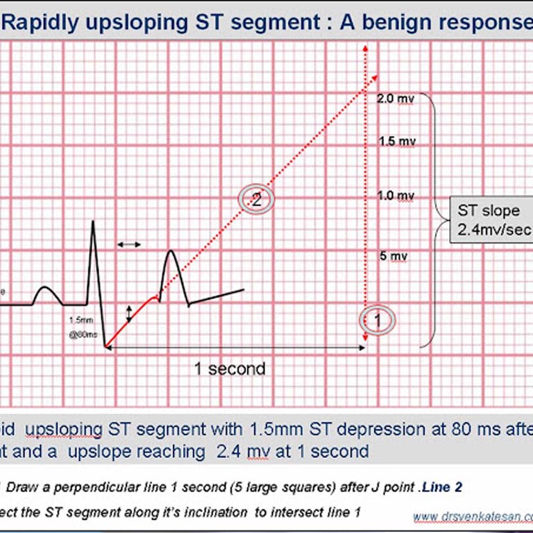ECG & TMT Babbar Hospital
